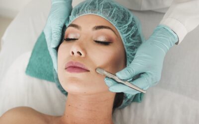 Why do you need to try Microneedling?